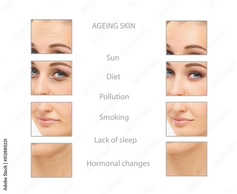 Ageing skin ,internal and external causes of skin aging, signs of skin ...