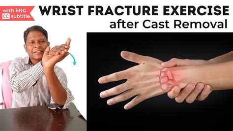 Wrist Fracture Exercise in Hindi - YouTube