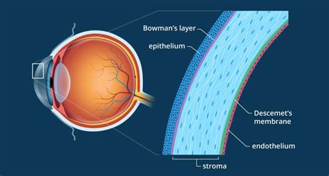 Revolutionising treatment of Fuchs’ Endothelial Dystrophy: Can corneal transplant be avoided ...