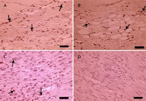 Histology of the longitudinal section of the Achilles tendon. One week... | Download Scientific ...