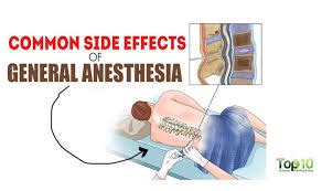 Side Effects of General Anesthesia You Must Know – QuickRecipes