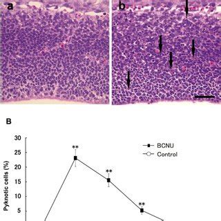 A. Histology of the telencephalic wall of a control fetus (a) and that... | Download Scientific ...