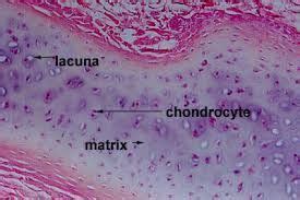 There is lacunae present within the matrix. The chondrocytes are ...