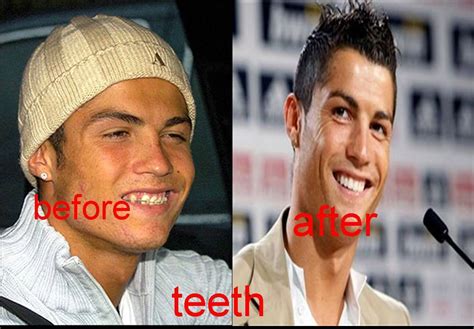 ronaldo teeth - Soccer Photo (16661218) - Fanpop