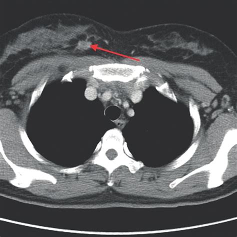 Contrast-enhanced chest CT imaging. Contrast-enhanced chest CT imaging... | Download Scientific ...