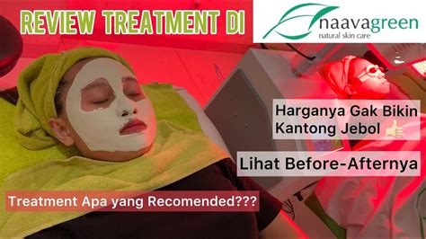 Hasil Treatment di Naavagreen | Review Micropeeling Brightening - YouTube