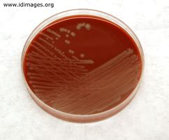 Pasteurella Multocida Human Infection