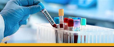 Blood Lab Testing Clinic Near Me | Priority Urgent Care