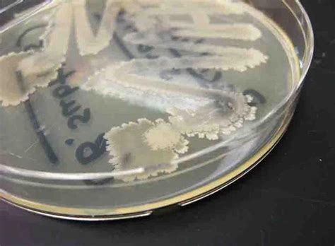 Bacillus subtilis bacterial colonies grown on TSY agar | Bacillus ...