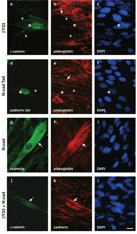 The effect of β-catenin and N-cadherin derivatives overexpression on... | Download Scientific ...