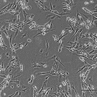 Phase contrast microscopy showing that Sertoli cells exhibit a ...