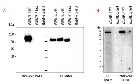 Nonsense-mediated mRNA decay in the ADAMTS13 gene caused by a 29 ...