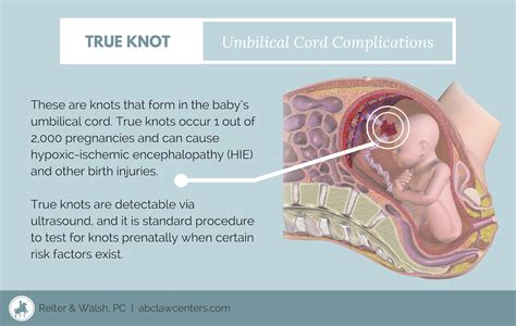 Pin on Birth Injury