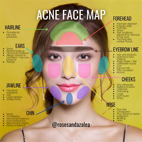 Face mapping your acne – Artofit