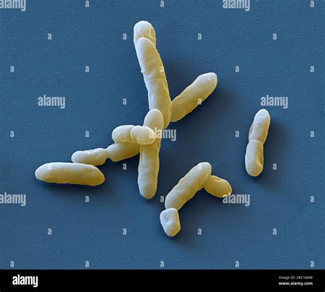 Cronobacter sakazakii bacteria, SEM Stock Photo - Alamy