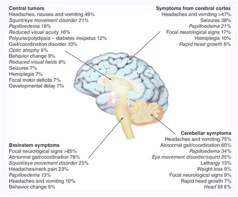 33 Top Images Brain Stem Tumor In Cats : Your Marvellous Brain. Part 1 ...