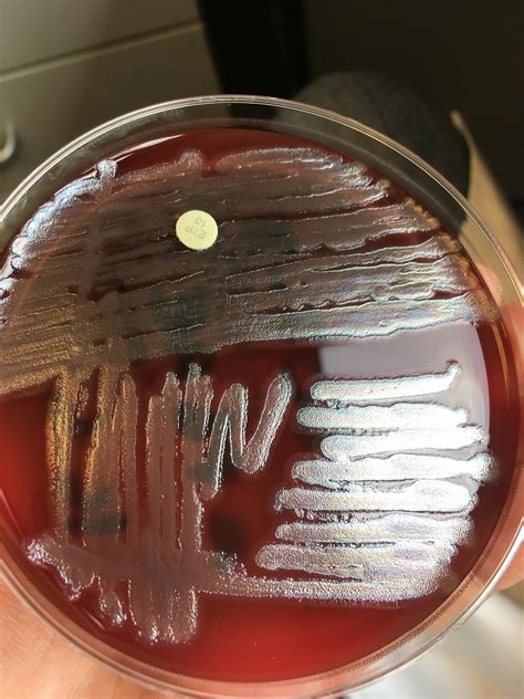 Contaminant in Pseudomonas culture — Can anyone identify? : microbiology