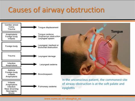 PPT - Based on: European Resuscitation Council Guidelines for Resuscitation 2010 PowerPoint ...