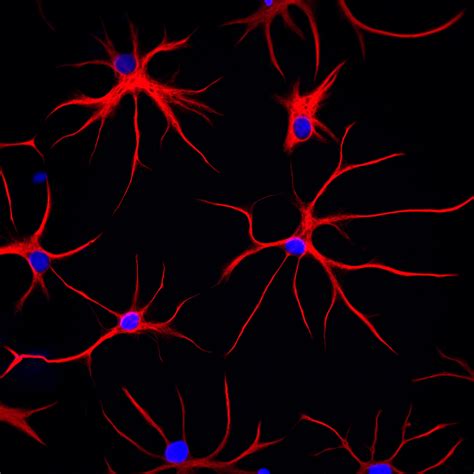 Mutation in common protein triggers tangles, chaos inside brain cells