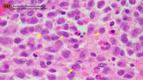 Langerhans Cells Histology