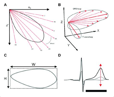 | (A) T-wave morphology dispersion (degrees) (TMD) is based on the ...