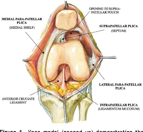 Synovial plicae of the knee | Semantic Scholar