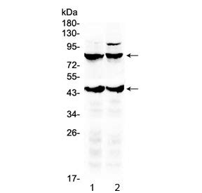 TSH Receptor Antibody | R32688 NSJ Bioreagents