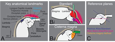 Cisterna Magna Anatomy