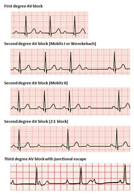 Pin on acls cheat sheetacls