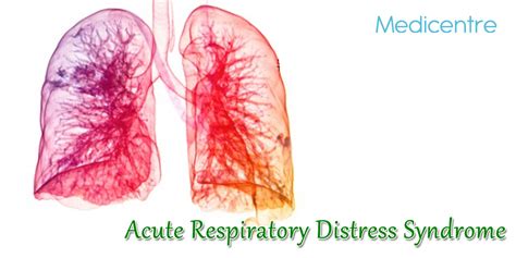 Acute Respiratory Distress Syndrome Ards Etiology Clinical