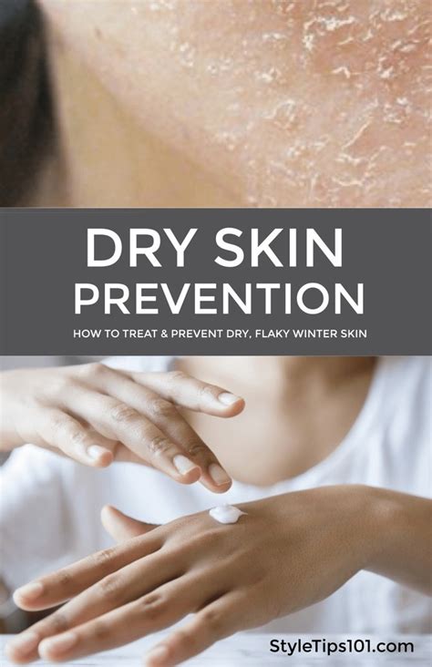 Flaky, Dry Skin Prevention and Treatment