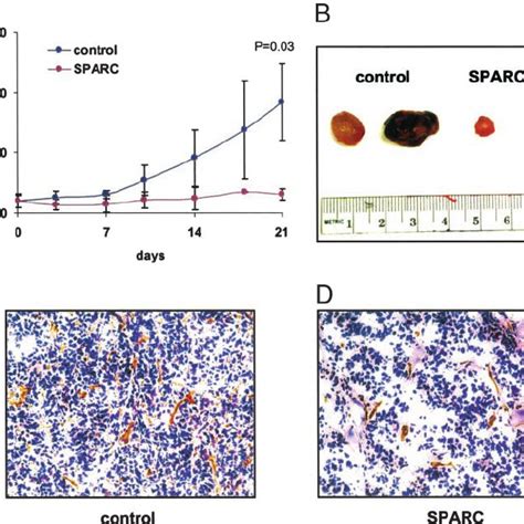 SPARC inhibits NB tumor growth in vivo . A and B, short-term delivery ...