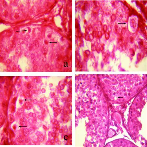 Photomicrograph of apoptotic germ cells (a) showing dark, pyknotic... | Download Scientific Diagram