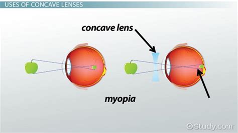 Lens Uses : How To Use Cinema Zoom Lenses B H Explora - There are various uses of a convex lens ...