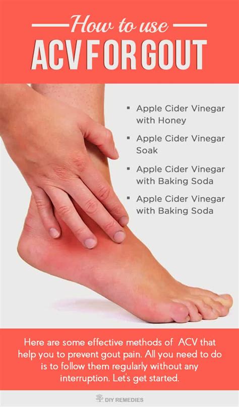 How-to-use-Apple-Cider-Vinegar-for-Gout - DIY Natural Home Remedies