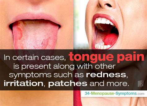 Tongue Pain: Important Things to Know | Menopause Now