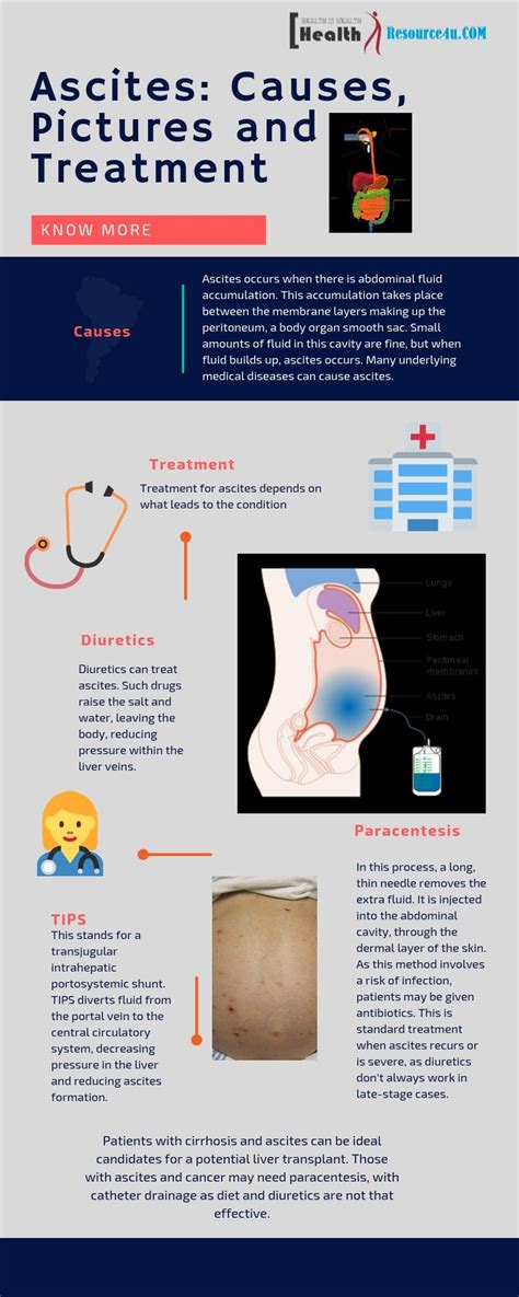 Ascites: Causes, Pictures, Symptoms And Treatment