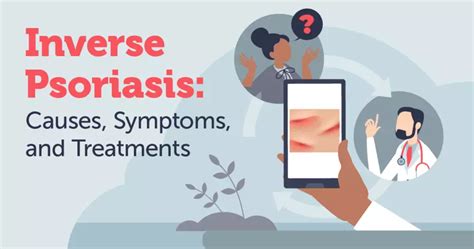 Inverse Psoriasis: Causes, Symptoms, and Treatments | MyPsoriasisTeam