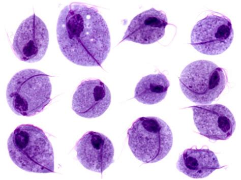 Lab Diagnosis of Trichomonas vaginalis infections – Microbe Online