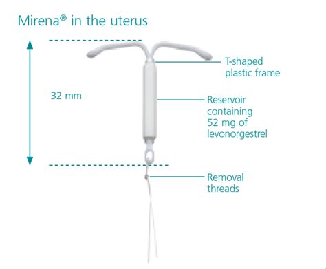 Mirena® Coil | 52mg Levonorgestrel Intrauterine System|Bayer