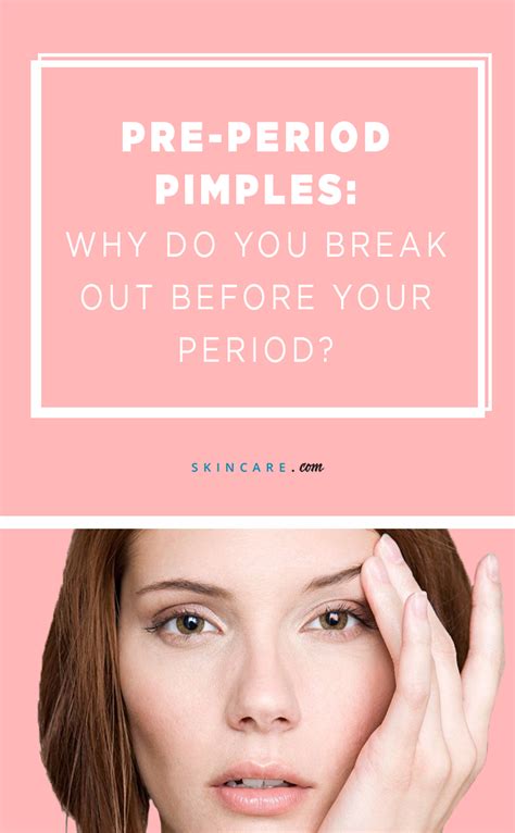 This Is Why You Break Out Before Your Period | Skincare.com by L'Oréal | Period pimples, Pimples ...