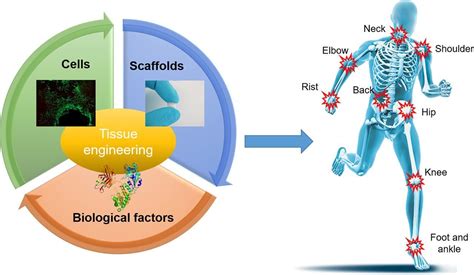 30 years of tissue engineering, what has been achieved? | World ...