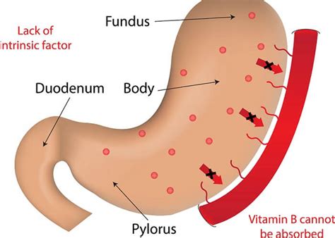 Intrinsic Factor - The Definitive Guide | Biology Dictionary