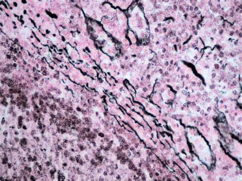 Reticular Connective Tissue