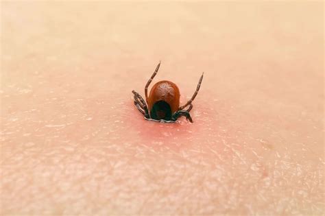 tick bite - Pointe Pest Control: Chicago Exterminator & Pest Control ...