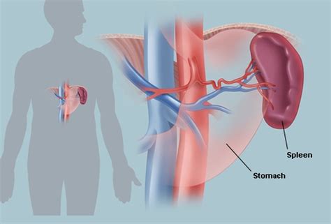 Spleen Disorders - Ask Hematologist | Understand Hematology