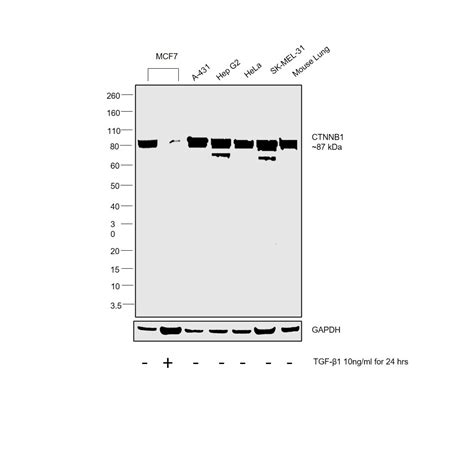 beta Catenin Antibody (PA1-37255)