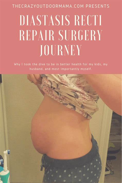 Diastasis Recti Repair Surgery: Pt1 – The Crazy Outdoor Mama