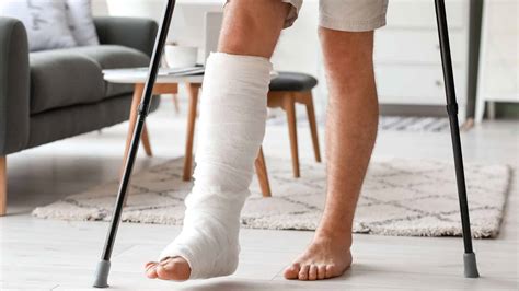 4 Signs to Know if You Have a Broken Leg - Elite Hospital Kingwood