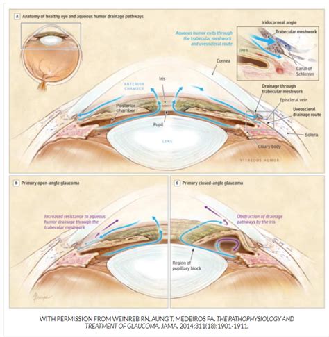 Clinical Presentation